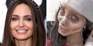 Angelina jolie's recent breast reconstruction opened up a discussion on surgical options. Before After Photos Of The Woman Rumored To Have Undergone 50 Surgeries To Look Like Angelina Jolie