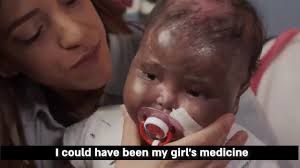 At 4 months old, Efrat received her first chemo, Its unbelievable!"