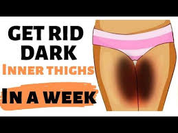 Leave it on for another few minutes and rinse off with cold water. How To Get Rid Of Dark Inner Thighs Just In A Week Home Remedy For Dark Inner Thighs Youtube Lighten Inner Thighs Dark Patches On Skin Dark Inner Thigh