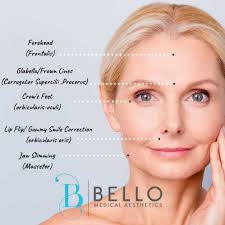 Botox Bello Medical Aesthetics