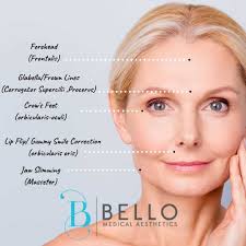 botox bello medical aesthetics