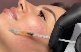 دورة التجميل الطبيعي الشاملة