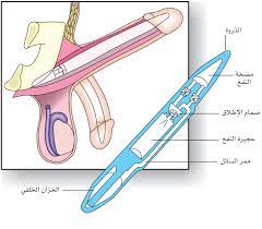 الموسوعة العربية | الاضطرابات الجنسية في الذكور