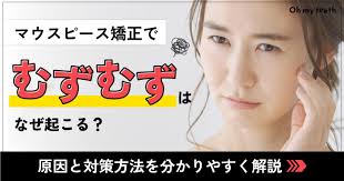 マウスピース矯正でのむずむずはなぜ起こる？対策方法も解説