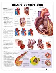 Heart Conditions Anatomical Chart