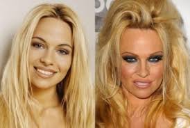 Tom Izzo—Good Knight Sweet Prince