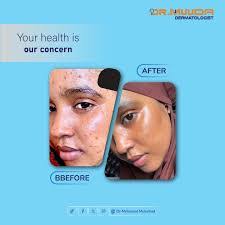 Miski Mohamed's Instagram, Twitter & Facebook