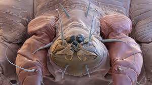 A comparative study of oral ivermectin and topical permethrin cream in the treatment of scabies. Scabies Means Misery This Pill Can End It The New York Times
