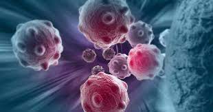 Colon cancer typically affects older adults, though it can happen at any age. Cancer When Good Cells Go Bad Ctca
