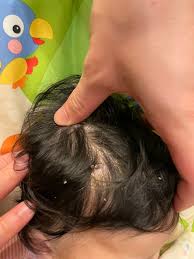 幼之園診所- 皮膚專區