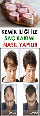 Kemik Iligi Ile Sac Bakimi Nasil Yapilir Www Vipbakim Com Kemik Iligi Sac Bakimi Sac