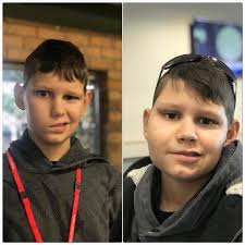 The Fight for Caleb's Smile