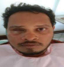 Indian Journal of Odontostomatology Vol. 1 ○ No. 1 ○ DEC 2021 AAA SStt...  GGrreeggoorriioosss DDeennttaalll CCoolllleeggeee