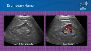 The dromedary was probably domesticated from wild ancestors roaming in the arabian peninsula. Dromedary Hump Nephropocus