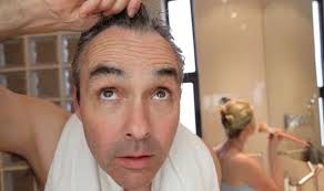 Vitamin d deficiency is not an incurable or unpreventable deficiency. Vitamin D Deficiency Symptoms Hair Loss Is A Warning Sign You May Be Deficient Express Co Uk