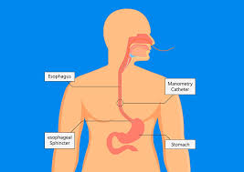 Manometry | Gastro Associates
