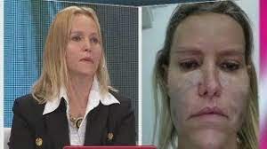 Lotocki reveló que no es cirujano plástico y sacudió a la farándula. Caso Extremo Se Opero Con Anibal Lotocki Y Hoy Vive Un Completo Infierno Youtube