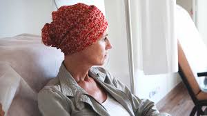 chemotherapy and hair loss timing