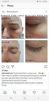 (click here to get yours) algenist firming & lifting serum cream the name says it all. How To Get Rid Of 11 Lines Between Eyebrows Eyebrowshaper