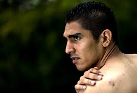 I put my finger in a hole in my head and remember the blood pouring down  over my face'