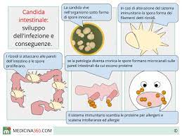 11 l'alimentazione giusta la candida è un lievito benigno che vive di zuccheri, quindi si consiglia di eliminare dalla propria dieta gli zuccheri semplici come lo zucchero e il miele per almeno tre mesi, evitando successivamente comunque gli zuccheri raffinati. Candida Intestinale Sintomi Diagnosi Cura Dieta E Rimedi Naturali