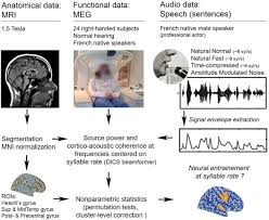 Listeners are presented with highly compressed speech. Neural Oscillations Track Natural But Not Artificial Fast Speech Novel Insights From Speech Brain Coupling Using Meg Biorxiv