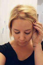 I have a great deal of respect for susie, so i asked her. Does Chemically Dying Your Hair Cause Hair Loss Hubpages