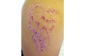 Da ich mir ein tribal ta. Vorsicht Vor Henna Tattoos Im Urlaub