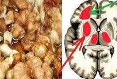 как избавиться от грибка в ухе в домашних условиях Spasitelnyj Eliksir Dlya Sosudov Pamyat Uluchshilas Ischez Shum V Ushah Davlenie V Norme S Izobrazheniyami Zdorove Poleznaya Dieta Produkty Dlya Zdorovya