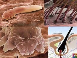 Habervitrini.com | Milyonlarca Demodex insanların yüzünde yaşıyor
