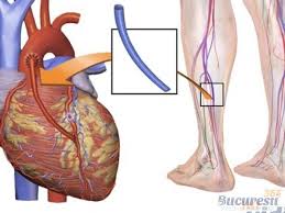 Angina pectorala este de mai multe tipuri Angina Pectorala Angina Pectorala Simptome Tratament Angina Pectorala