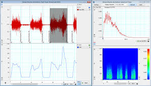 Lab Chart Reader For Mac How To Measure Amplitude Programlit