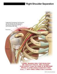 Shoulder Separation Acromioclavicular Joint Shoulder Anatomy Human Anatomy And Physiology