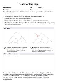 Image result for PCL Sag Test