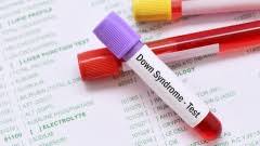 Testing correctly classified 16 of 17 cases of trisomy 21, nine of 10 cases of trisomy 18, one of two the number of cases of trisomies 18 and 13 was too small for accurate assessment of predictive. Trisomie 21 Evangelisch De