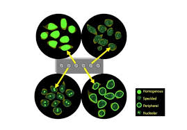 Image result for ANA Staining Pattern