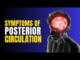 Image result for Posterior Circulation