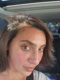 Donna Saxon Ridgle: ASKING FOR PRAYER . Please pray for me for me I am in  hospital with a hair line crack in plevi