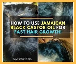 Natural methods of treating hair problems is the best way to go, because they are effective and at the same there are numerous benefits of jamaican black castor oil, but you have to be patient; Jamaican Black Castor Oil For Hair Growth Thinning Edges