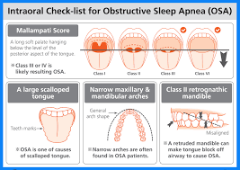 These patients merit special attention from both the sleep physician and the anaesthetist. What Is Your Mouth Telling You About Your Sleep Raphaelson Sleep Center
