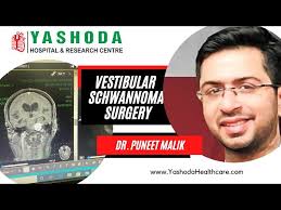 Vestibular Schwannoma Surgery performed by Dr. Puneet Malik at Yashoda  Hospital Ghaziabad