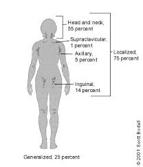 Your lymph nodes, also called lymph glands, play a vital role in your body's ability to fight off infections. Lymphadenopathy Differential Diagnosis And Evaluation American Family Physician