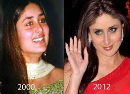Kareena Kapoor Before And After Plastic Surgery Cosmetic Surgery Plastic Surgery Celebrity Plastic Surgery When you compare the pictures of her debut and recent.