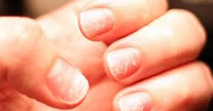 We did not find results for: What Do Nail Problems Mean For Your Health