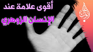 أسباب و أعراض مرض الزهري (السيفلس) و الخيارات العلاجية المتوفرة. Ù…Ø§ Ù‡ÙŠ Ø£Ù‚ÙˆÙ‰ Ø¹Ù„Ø§Ù…Ø© Ø¹Ù†Ø¯ Ø§Ù„Ø¥Ù†Ø³Ø§Ù† Ø§Ù„Ø²ÙˆÙ‡Ø±ÙŠ Youtube