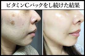 必見 ニベアに を混ぜるだけで 顔のシミがスッキリ 奇跡の50歳美魔女が愛用リピートしてる 世界特許の白い粉 が凄すぎる 顔のシミ シミ ニベア
