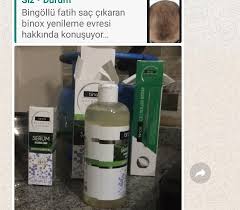 Sac Cikaran Binox Mu Yoksa Uraw Mi