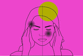Evidence suggests that magnesium deficiency is more common in people who get frequent migraine headaches,. What S The Difference Between A Headache And A Migraine Sarasota Magazine