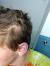 Signs Of Balding Male