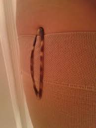 Pin By Barb Landers On Must Remembrt Compression Stockings Lymphedema Lymphedema Treatment